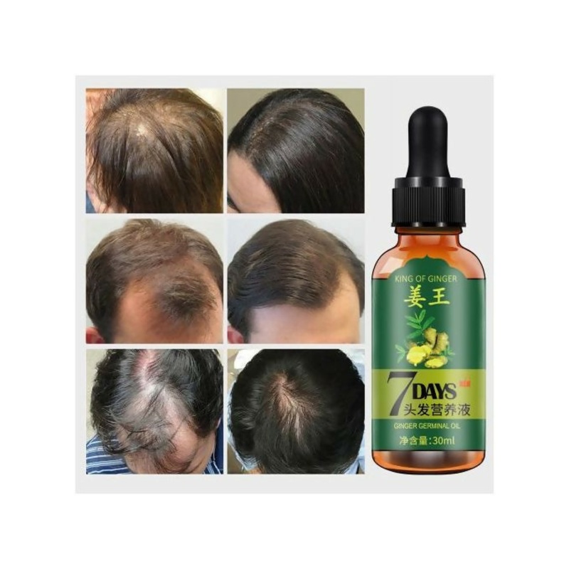 Aichun Beauty 7 Days King Of Ginger Germinal Hair Oil Growth Essence – 30ml