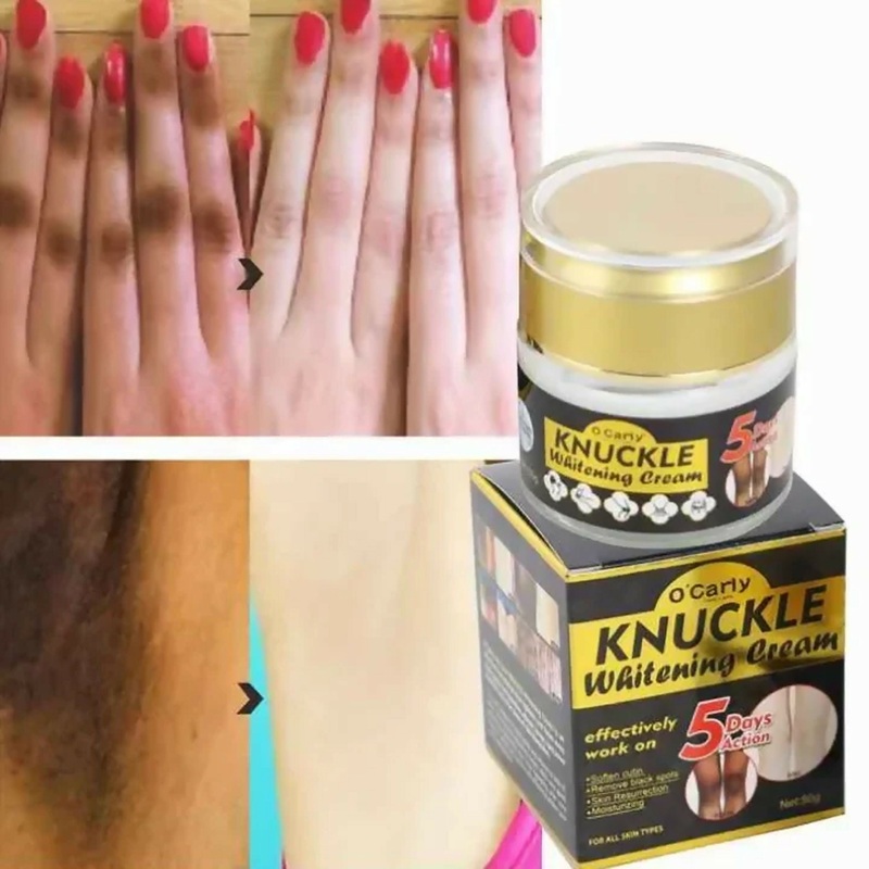 O’Carly Knuckle Whitening Cream