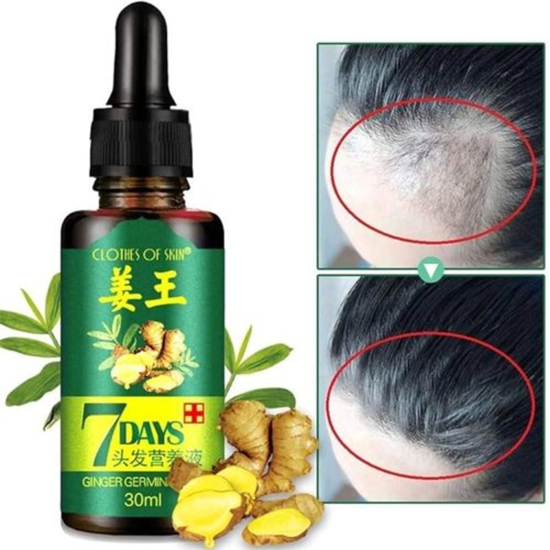 Aichun 7 Days Hair Growth Oil  Ginger & Herbal Tonic for Hair Regrowth & Anti-Hair Loss